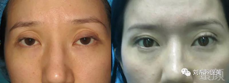 https://img.miyanlife.com/mnt/timg/180521/110310M29-3.jpg