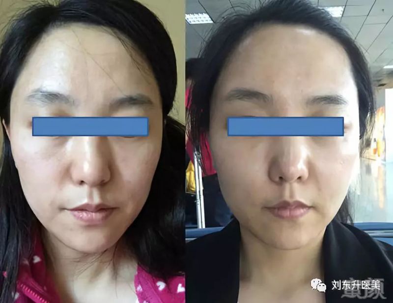 https://img.miyanlife.com/mnt/timg/180521/1103111352-6.jpg