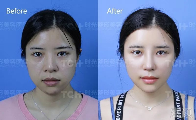 https://img.miyanlife.com/mnt/timg/180522/102G949D-8.jpg