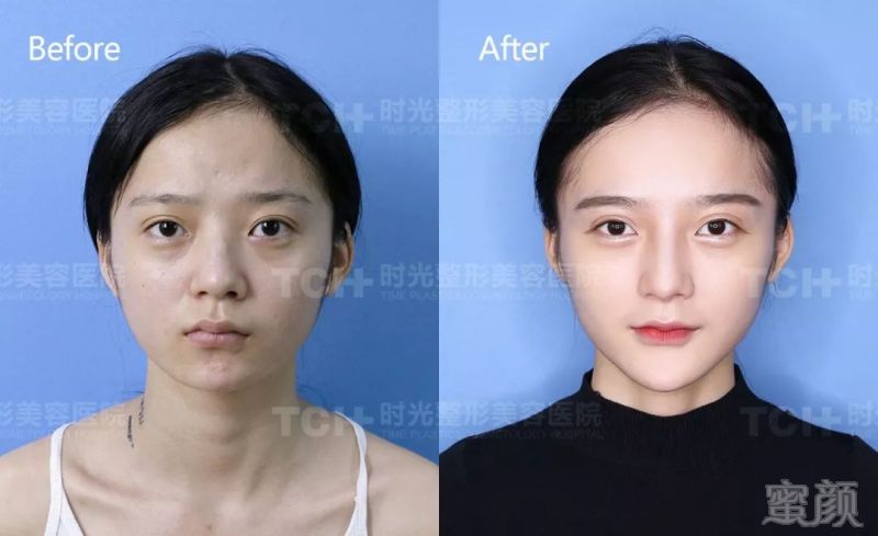 https://img.miyanlife.com/mnt/timg/180522/102H0C35-10.jpg