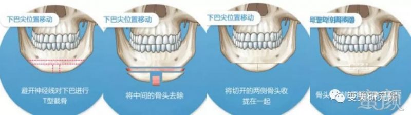 案例图片