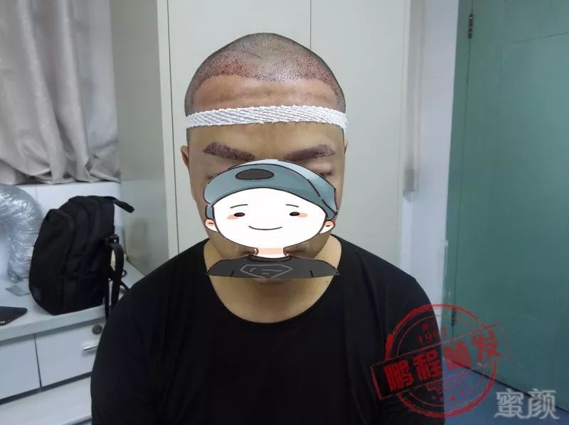 https://img.miyanlife.com/mnt/timg/180522/1052013228-1.jpg