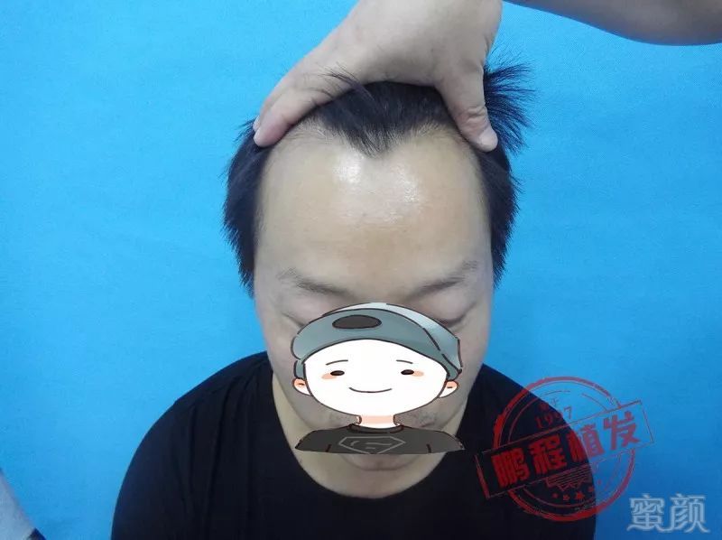 https://img.miyanlife.com/mnt/timg/180522/1052014129-0.jpg