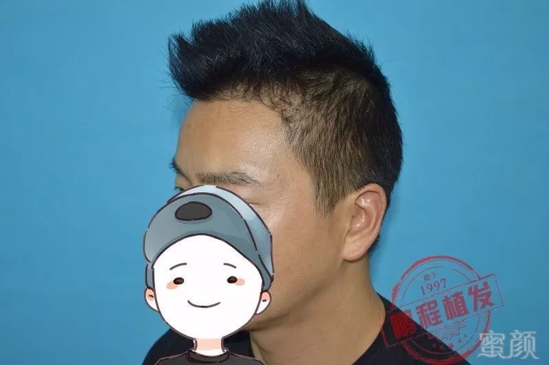 https://img.miyanlife.com/mnt/timg/180522/1052032416-5.jpg