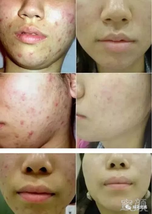 https://img.miyanlife.com/mnt/timg/180522/110H2J13-5.jpg