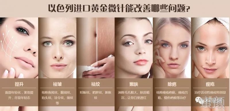 https://img.miyanlife.com/mnt/timg/180522/111R51332-5.jpg