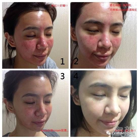 https://img.miyanlife.com/mnt/timg/180522/1120322W7-6.jpg
