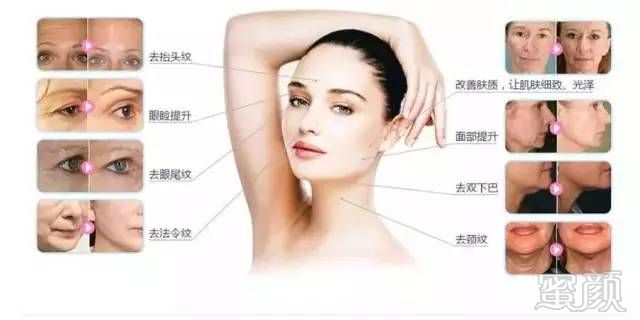 https://img.miyanlife.com/mnt/timg/180523/10560942c-5.jpg