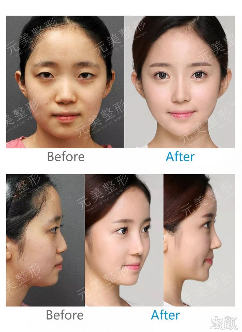 https://img.miyanlife.com/mnt/timg/180523/1056103537-11.jpg