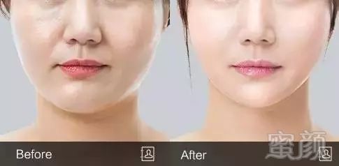 https://img.miyanlife.com/mnt/timg/180523/105610IH-6.jpg
