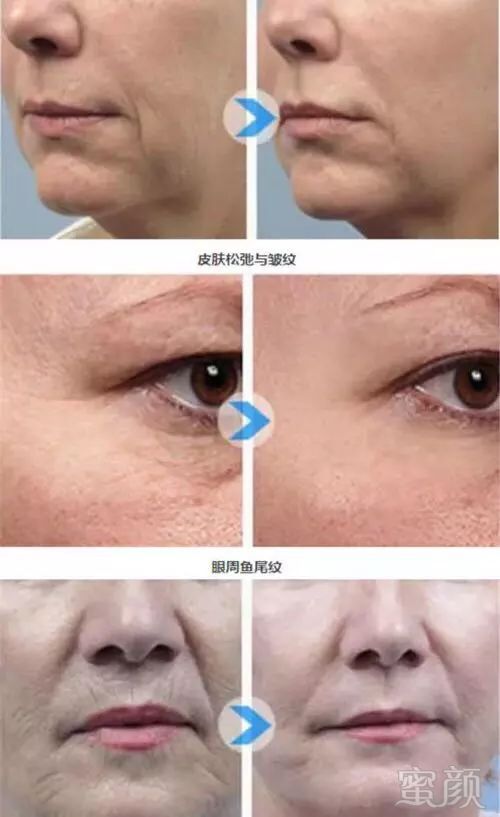 https://img.miyanlife.com/mnt/timg/180523/10561154U-12.jpg