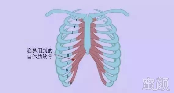 https://img.miyanlife.com/mnt/timg/180523/11203514M-0.jpg