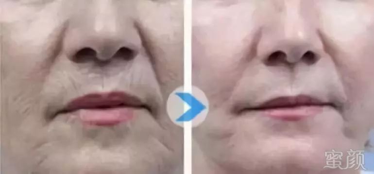 https://img.miyanlife.com/mnt/timg/180523/124110O61-10.jpg