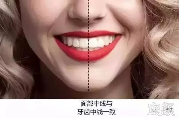 https://img.miyanlife.com/mnt/timg/180524/1012064360-9.jpg