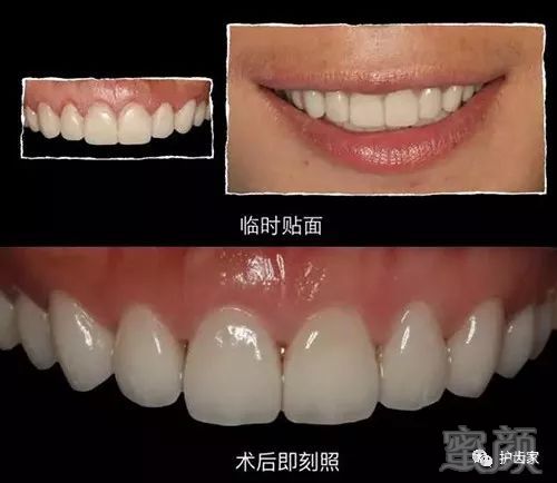 https://img.miyanlife.com/mnt/timg/180524/10120I193-13.jpg
