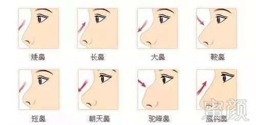 https://img.miyanlife.com/mnt/timg/180524/11492H2W-1.jpg