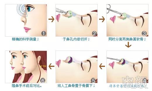 https://img.miyanlife.com/mnt/timg/180524/1149301263-3.jpg