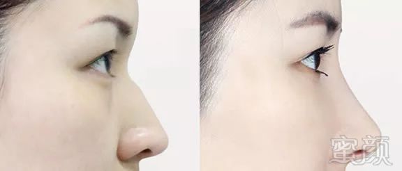 https://img.miyanlife.com/mnt/timg/180524/1149302S0-4.jpg