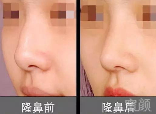 https://img.miyanlife.com/mnt/timg/180524/1149311S9-8.jpg
