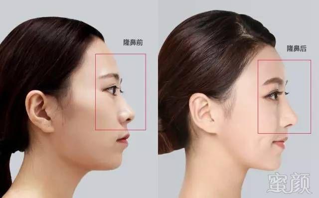https://img.miyanlife.com/mnt/timg/180524/1215144506-2.jpg