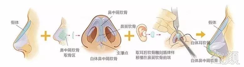 https://img.miyanlife.com/mnt/timg/180525/112034JX-3.jpg