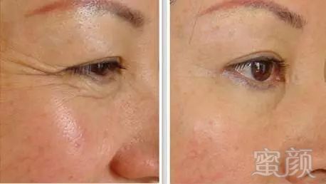 https://img.miyanlife.com/mnt/timg/180525/11495Ib8-7.jpg