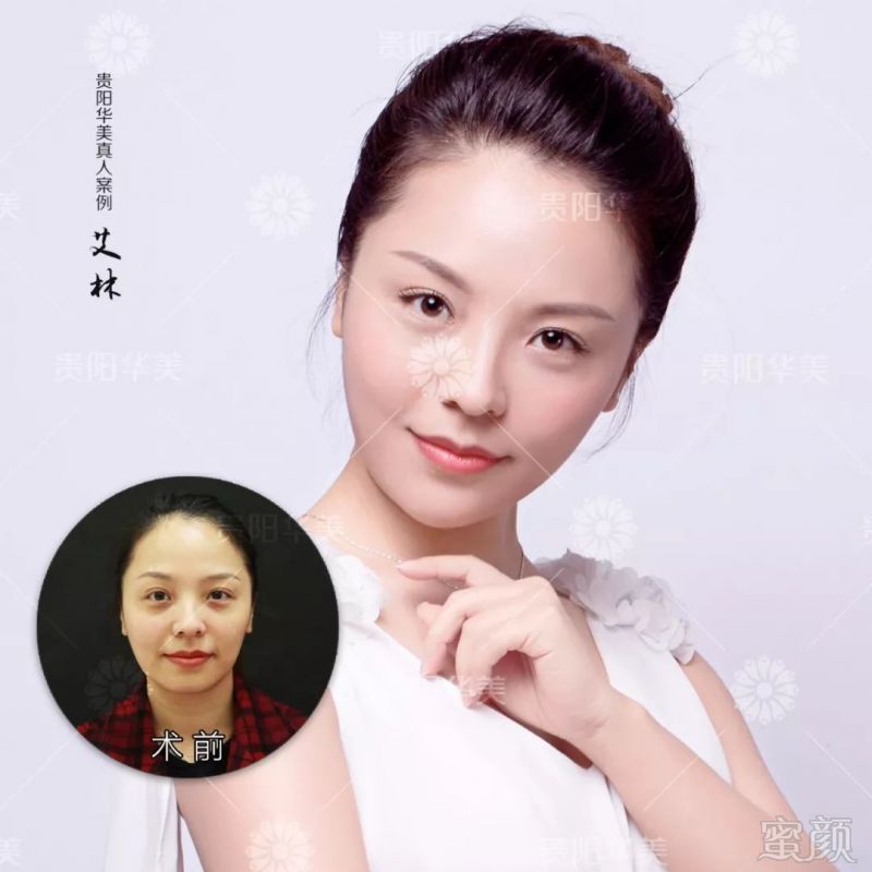 https://img.miyanlife.com/mnt/timg/180525/1202214443-14.jpg
