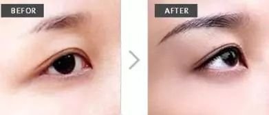 https://img.miyanlife.com/mnt/timg/180525/12032B5J-4.jpg