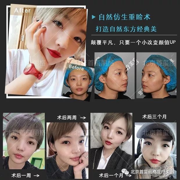https://img.miyanlife.com/mnt/timg/180525/12131A4N-3.jpg