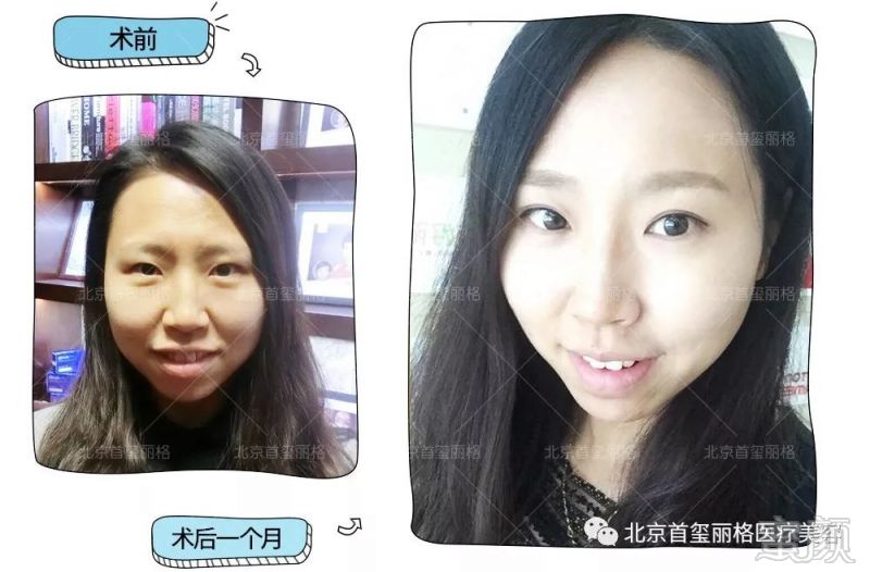 https://img.miyanlife.com/mnt/timg/180525/12131L034-6.jpg