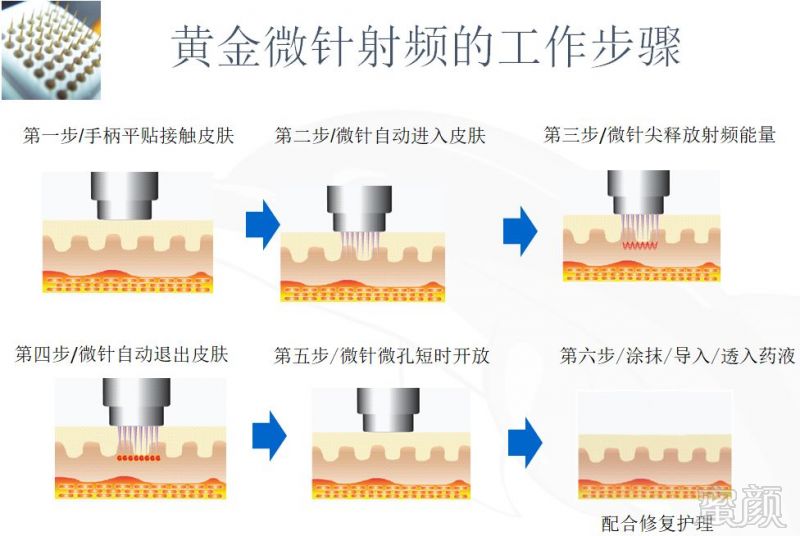 https://img.miyanlife.com/mnt/timg/180525/121Z41150-6.jpg