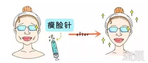 https://img.miyanlife.com/mnt/timg/180525/1224296441-0.jpg