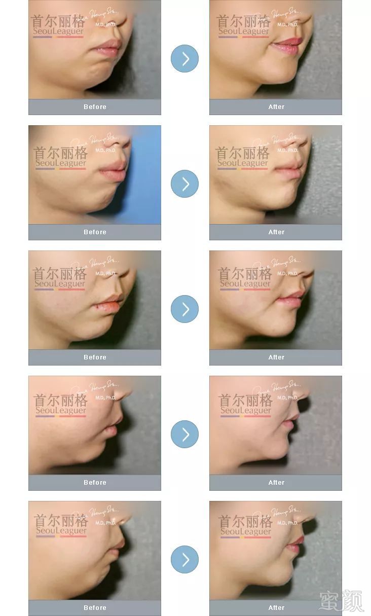 https://img.miyanlife.com/mnt/timg/180525/123124M52-4.jpg
