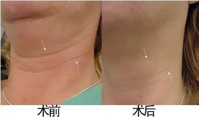 https://img.miyanlife.com/mnt/timg/180525/12510U448-2.jpg