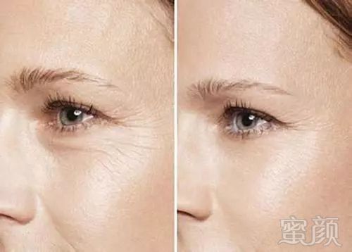https://img.miyanlife.com/mnt/timg/180525/125A634N-6.jpg