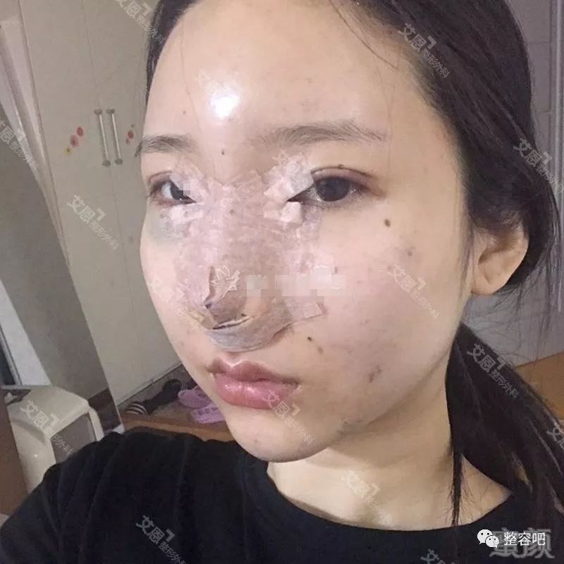https://img.miyanlife.com/mnt/timg/180525/1303552041-3.jpg
