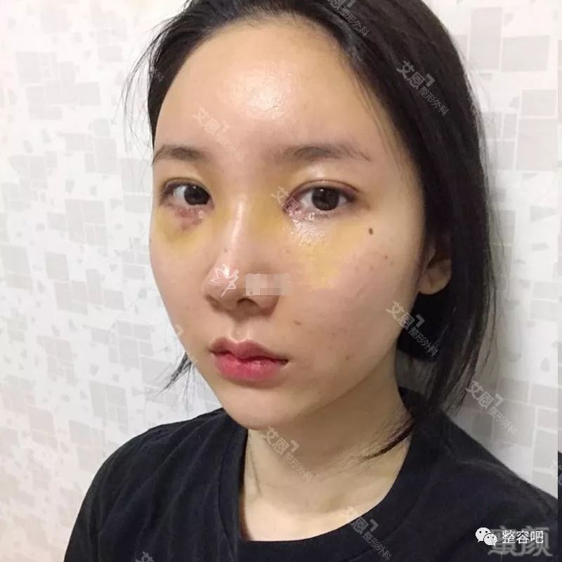 https://img.miyanlife.com/mnt/timg/180525/1303564595-4.jpg