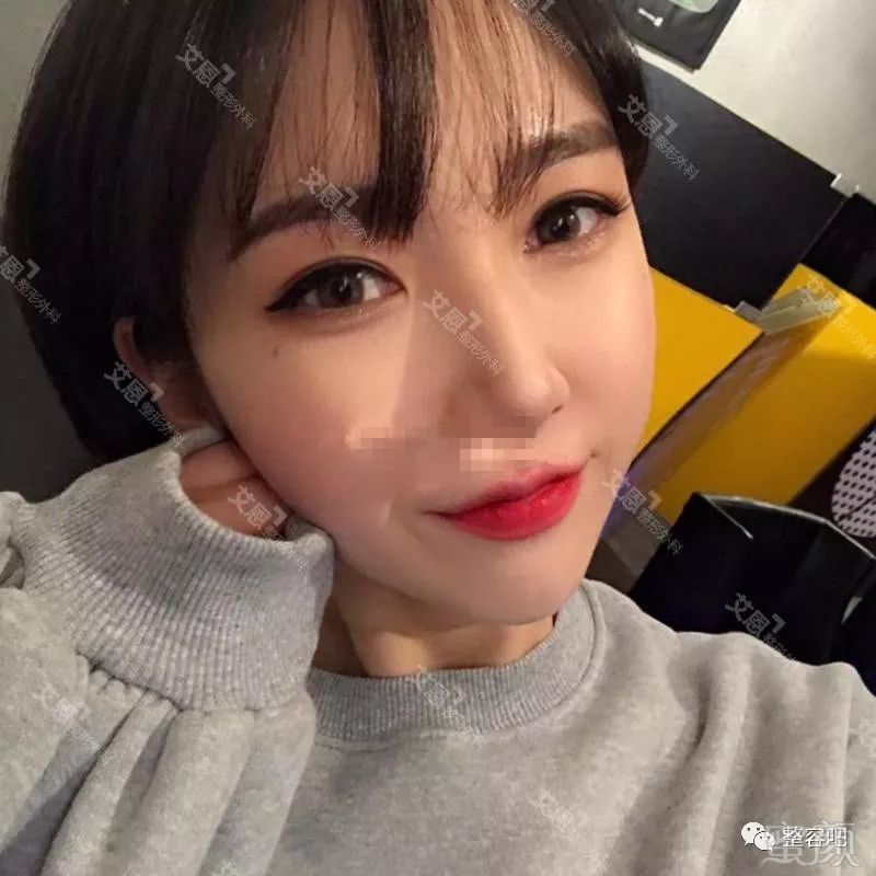 https://img.miyanlife.com/mnt/timg/180525/13035G957-6.jpg