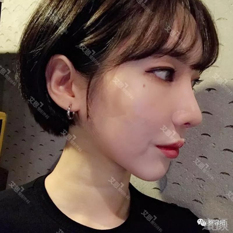 https://img.miyanlife.com/mnt/timg/180525/13035I5O-7.jpg