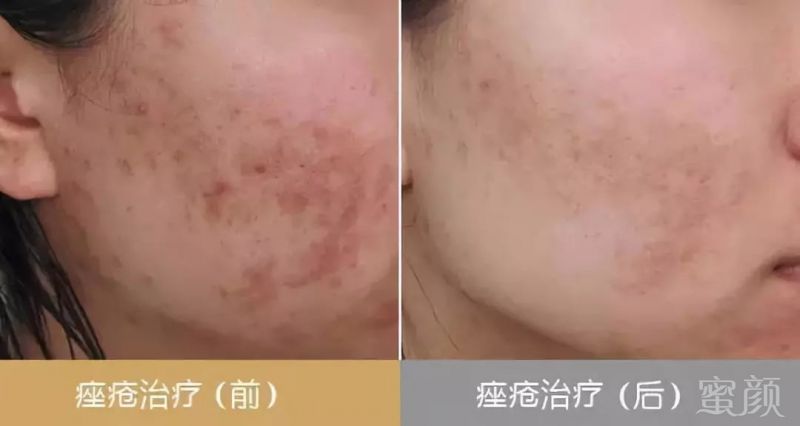https://img.miyanlife.com/mnt/timg/180525/1305291594-6.jpg