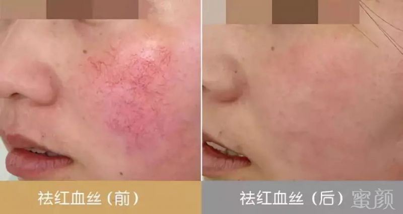 https://img.miyanlife.com/mnt/timg/180525/130529B44-7.jpg