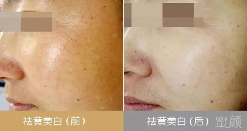 https://img.miyanlife.com/mnt/timg/180525/1305303122-8.jpg