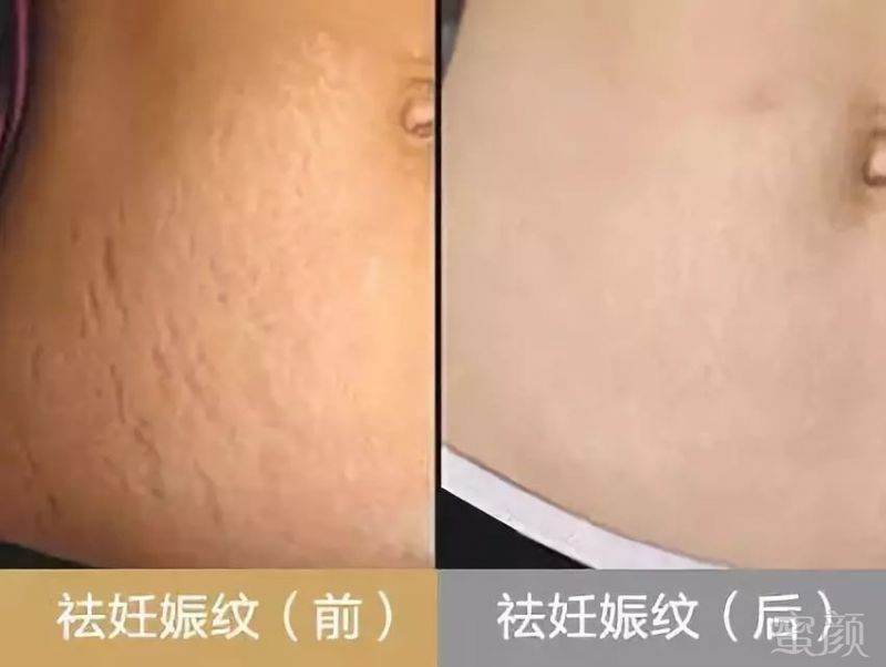 https://img.miyanlife.com/mnt/timg/180525/13053120P-13.jpg