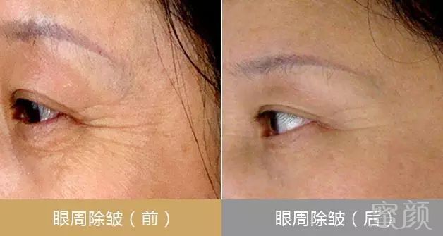https://img.miyanlife.com/mnt/timg/180525/1305313345-11.jpg