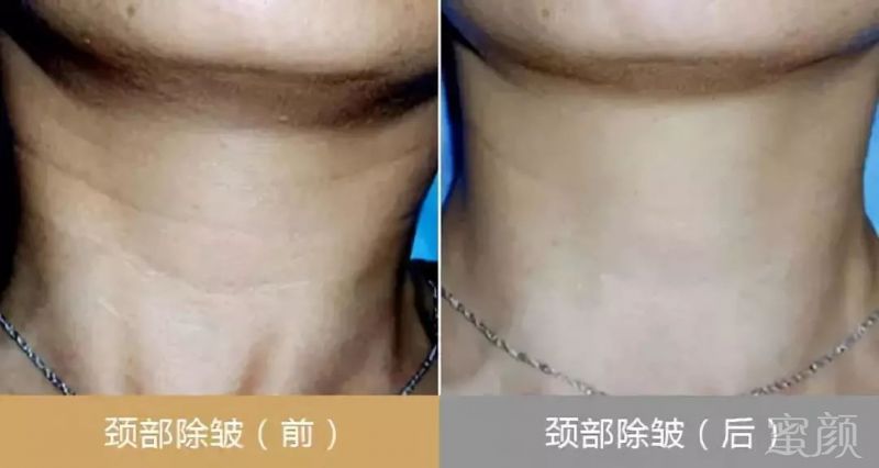 https://img.miyanlife.com/mnt/timg/180525/1305315216-12.jpg