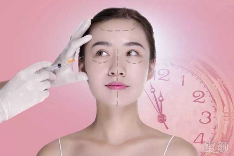 https://img.miyanlife.com/mnt/timg/180525/16243CM0-0.jpg