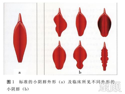 案例图片