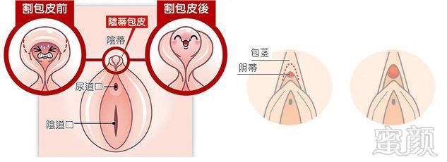 案例图片