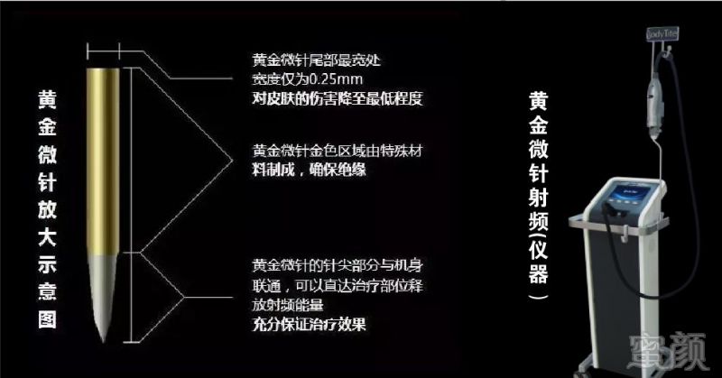 https://img.miyanlife.com/mnt/timg/180526/1102032E3-5.jpg