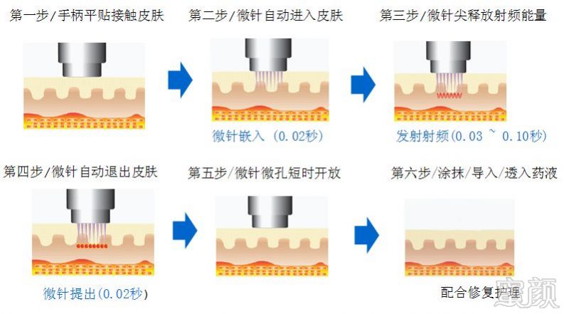 https://img.miyanlife.com/mnt/timg/180526/1102044533-6.jpg